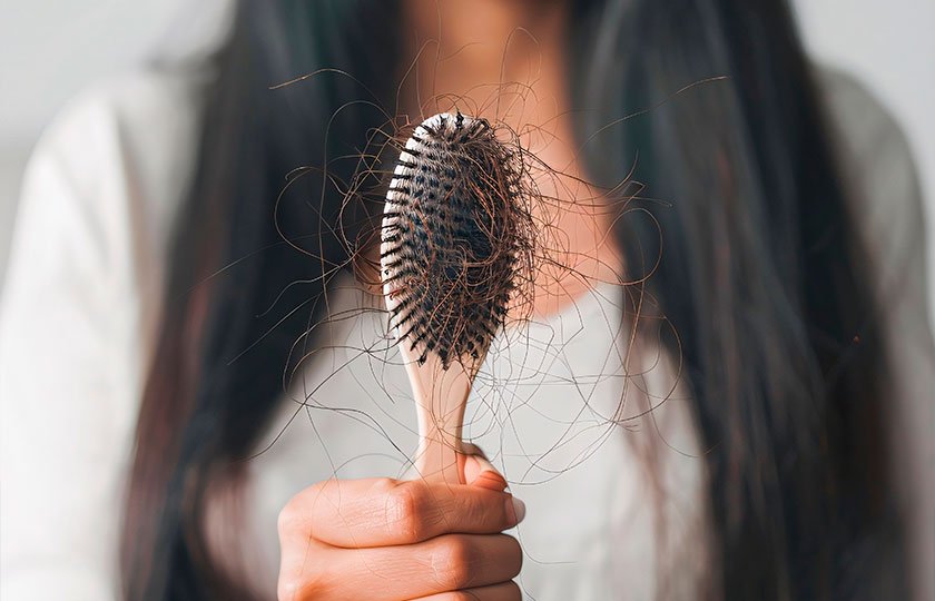 Queda de Cabelo Acentuada